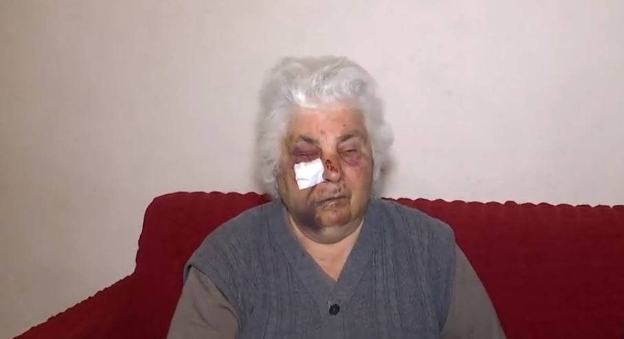 Θύμα άγριας ληστείας ηλικιωμένη στον Ασπρόπυργο: Συγκλονίζει η περιγραφή της – “Θα με σκότωναν”